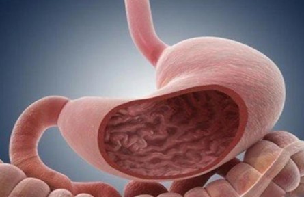 浅表性胃炎吃什么药？饮食疗法药品另外调养